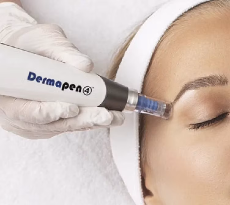 microneedling à l'institut de beauté Le centre Genève